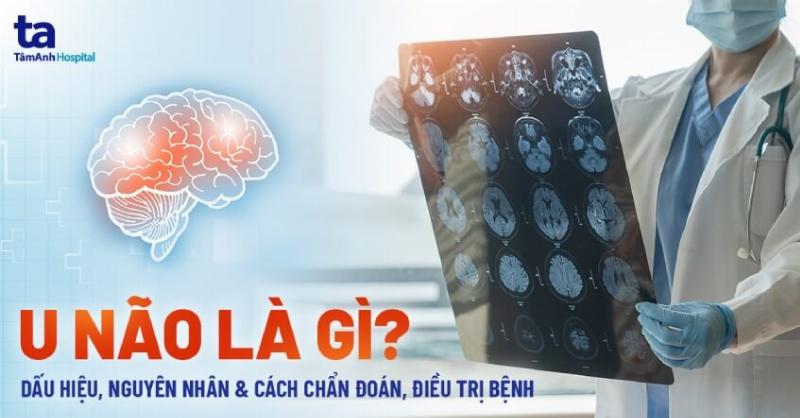 Minh họa công thức tính phân tử khối của một hợp chất đơn giản sử dụng đơn vị phân tử khối (u hoặc Da) với các nguyên tử được biểu diễn rõ ràng.